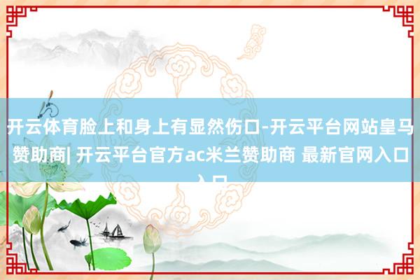 开云体育脸上和身上有显然伤口-开云平台网站皇马赞助商| 开云平台官方ac米兰赞助商 最新官网入口