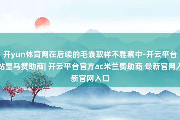 开yun体育网在后续的毛囊取样不雅察中-开云平台网站皇马赞助商| 开云平台官方ac米兰赞助商 最新官网入口